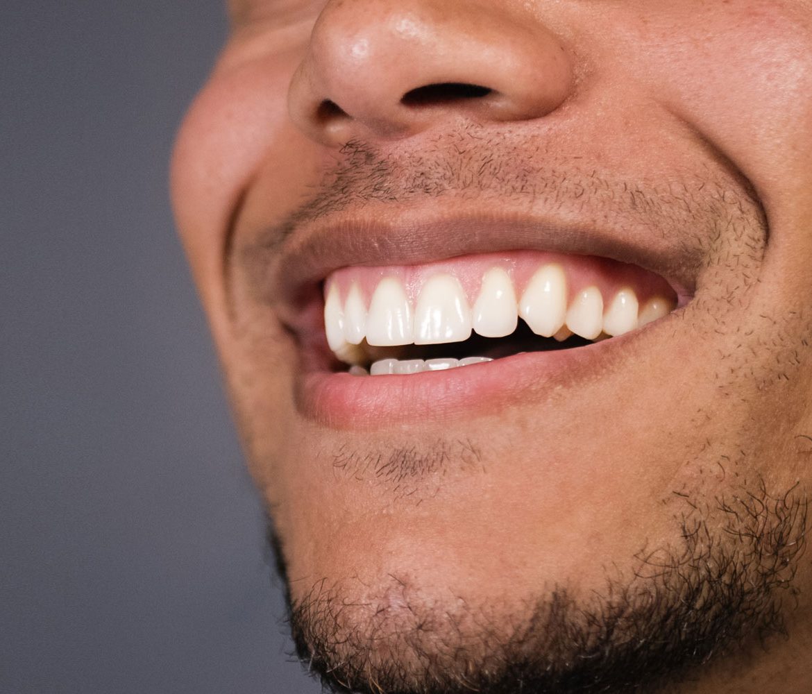 dental patient in need of gum grafting procedure