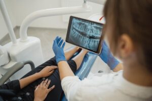 root canal therapy wall nj