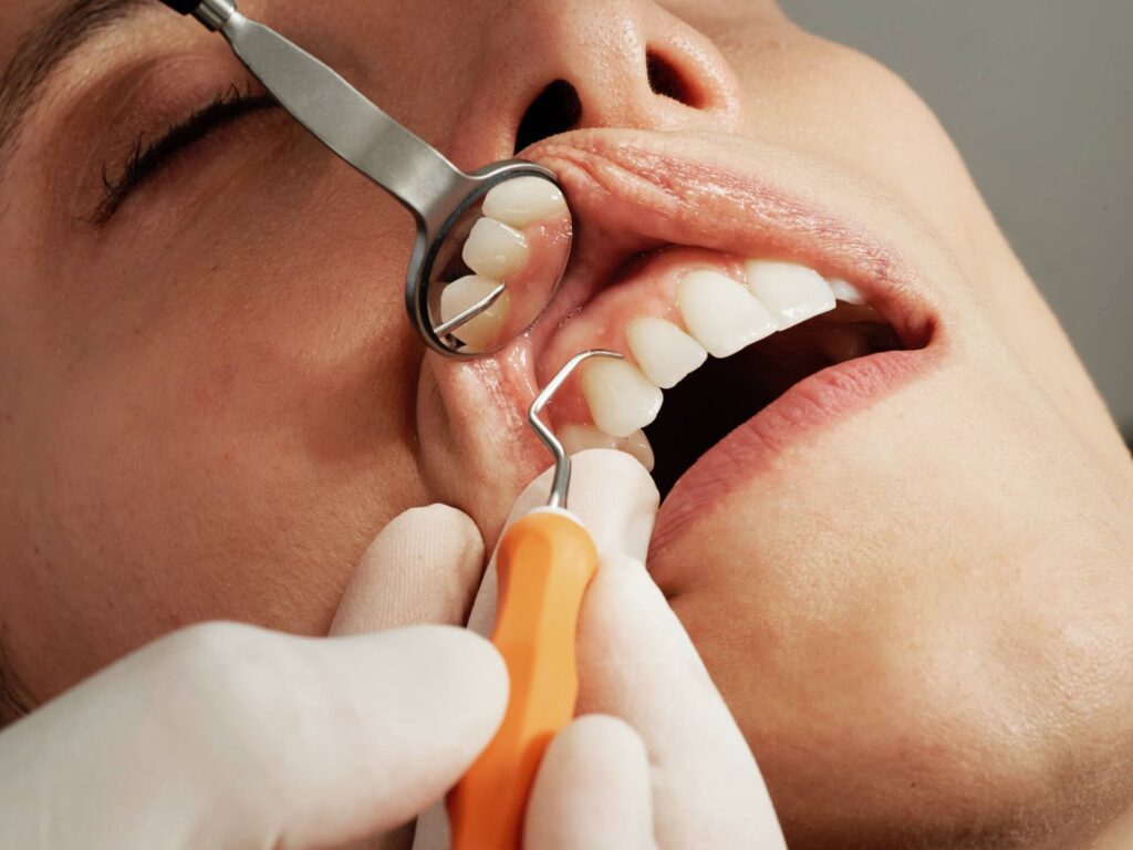 dental cleaning near me