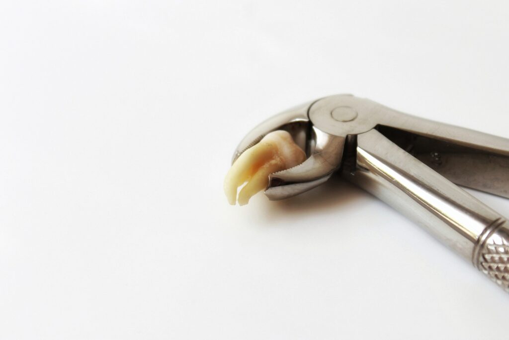 Wisdom teeth removal recovery tips