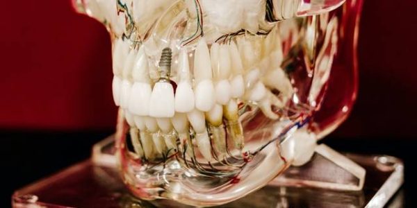 Photo of effects of vaping - oral health risks