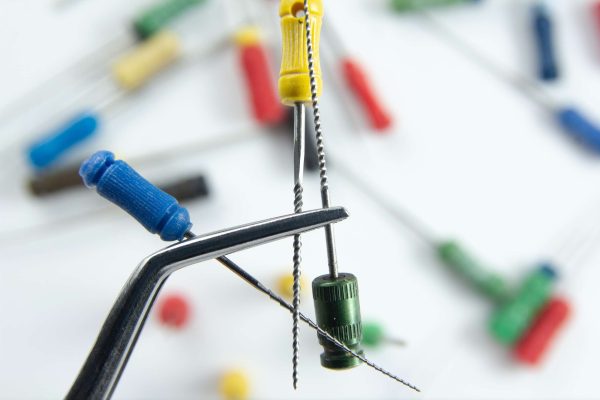 The Advantages of Root Canal Therapy