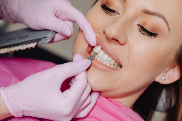 The Benefits of Porcelain Veneers for Your Oral Health