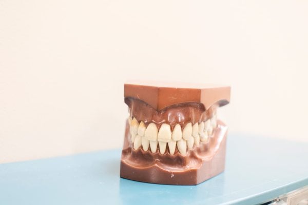 What is a dead tooth?